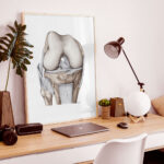 Plansza medyczna - Staw Kolanowy