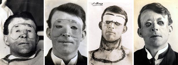 Wieloetapowa rekonstrukcja twarzy Waltera Yeo.
